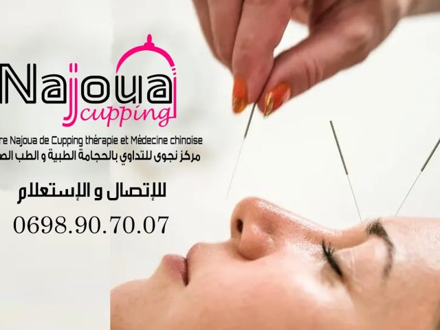Centre Najoua de cupping thérapie et médecine chinoise مركز نجوى للحجامة الطبية والطب الصيني - Marrakech - +212 698-907007