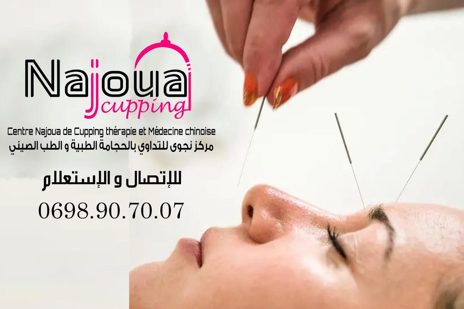 Centre Najoua de cupping thérapie et médecine chinoise مركز نجوى للحجامة الطبية والطب الصيني