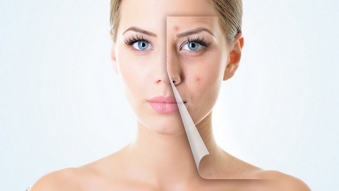 ESTHESLIM