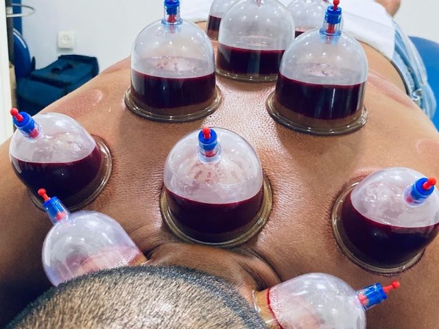 Natural Therapy - Hijama / Cupping therapy - Marrakech - +212 708-518409
