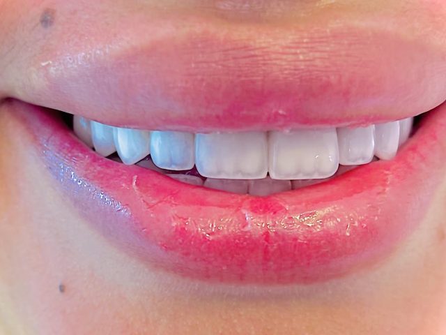 Chebbo Rached Ahmed (Dentiste) - Marrakech - +212 5243-00036