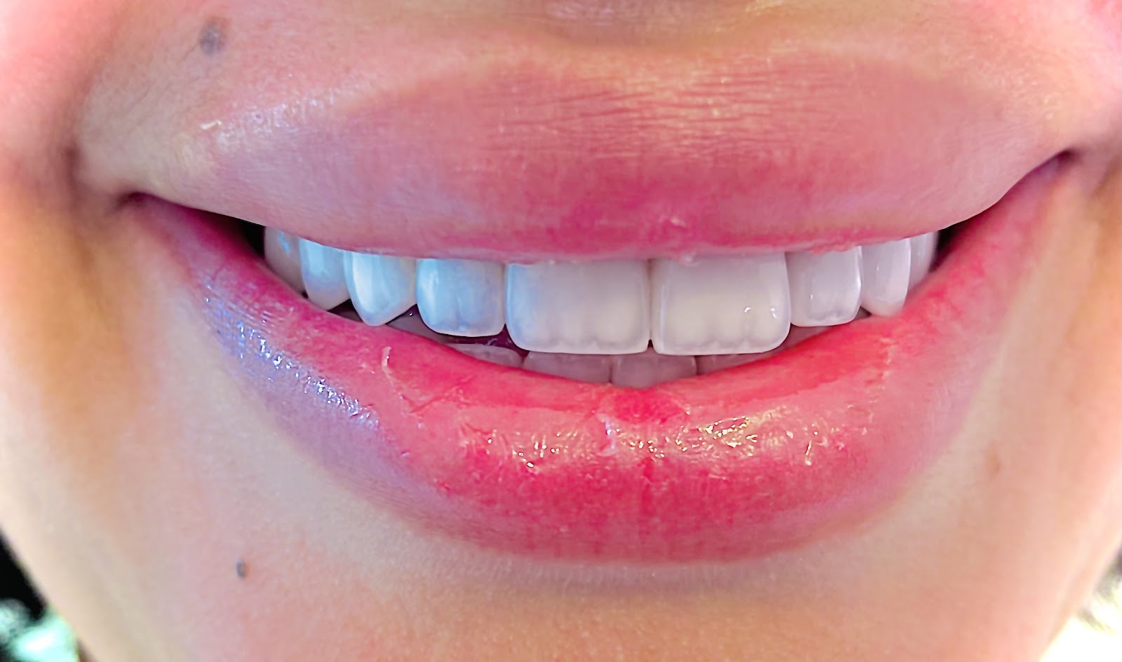 Chebbo Rached Ahmed (Dentiste) - Marrakech