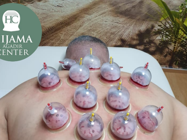 Hijama Agadir Center - حجامة أكادير سانتر - Agadir - +212 661-543667