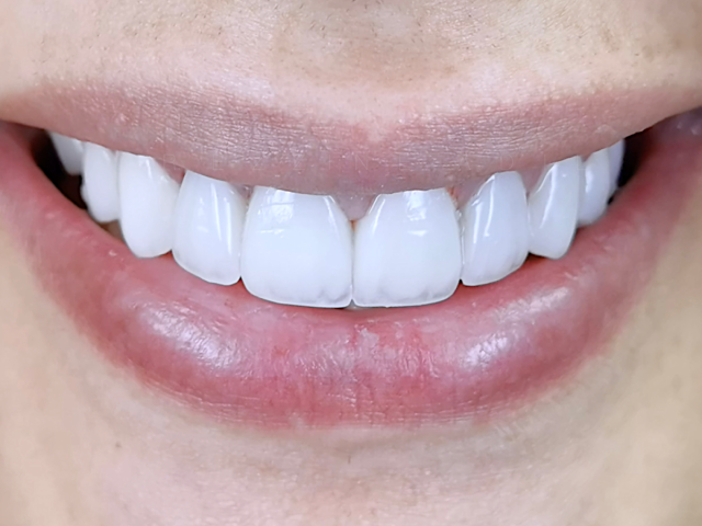 Centre Dentaire Ezzine - Salé - +212 5378-77768