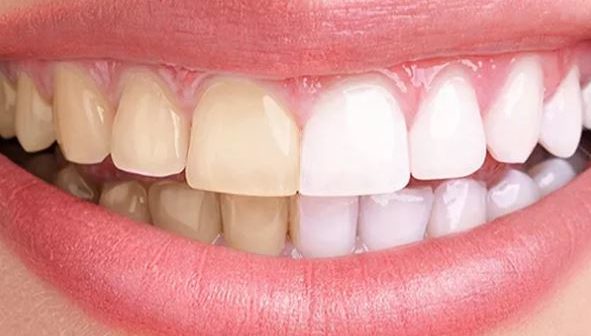 Docteur Mustapha Biya dentiste tetouan esthétique implantation orthodontie blanchiment orthopédie طبيب الأسنان الدكتور بيا مصطفى - Tétouan - +212 605-281616