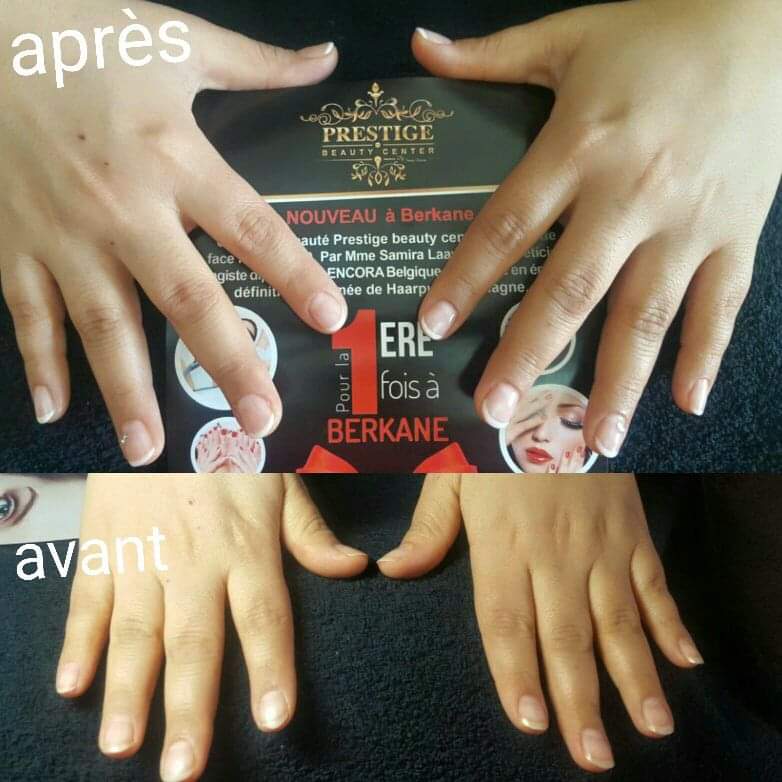 Prestige beaute cnt