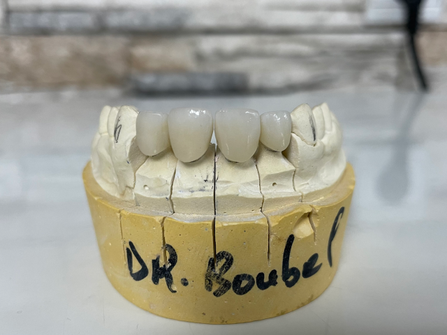 Dentiste Dr Boubel Tarik - Kénitra - +212 615-921063