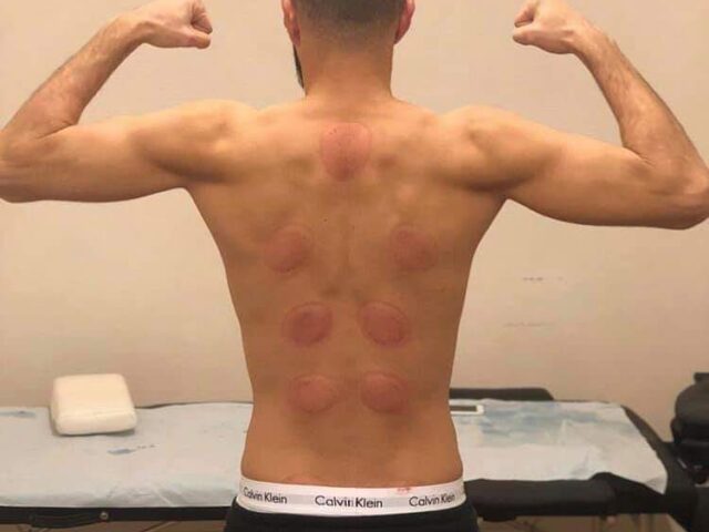 centre espace de kinésithérapie et bien etre - Fkih Ben Salah - +212 662-660293