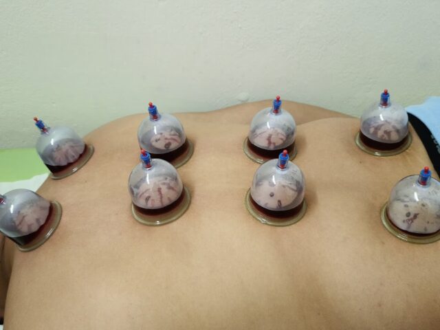 مركز طه لترويض الطبي و الحجامة centre Taha pour la kinésithérapie et hijama - Salé - +212 665-762434
